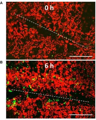 Escherichia coli O157:H7 Converts Plant-Derived Choline to Glycine Betaine for Osmoprotection during Pre- and Post-harvest Colonization of Injured Lettuce Leaves